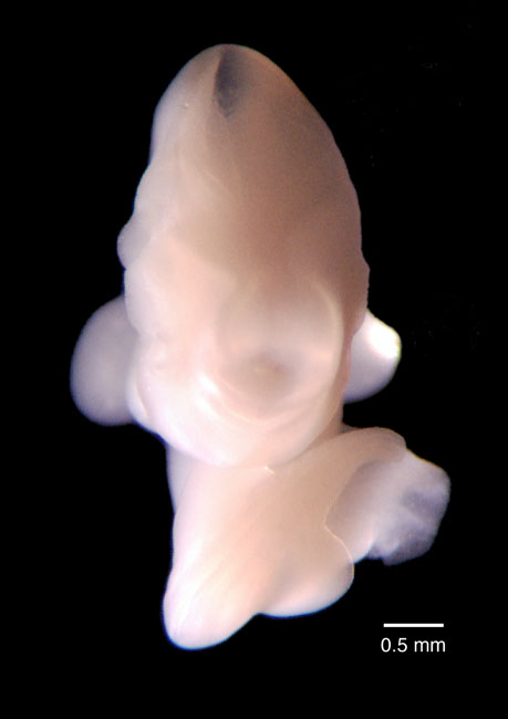 human embryo photograph