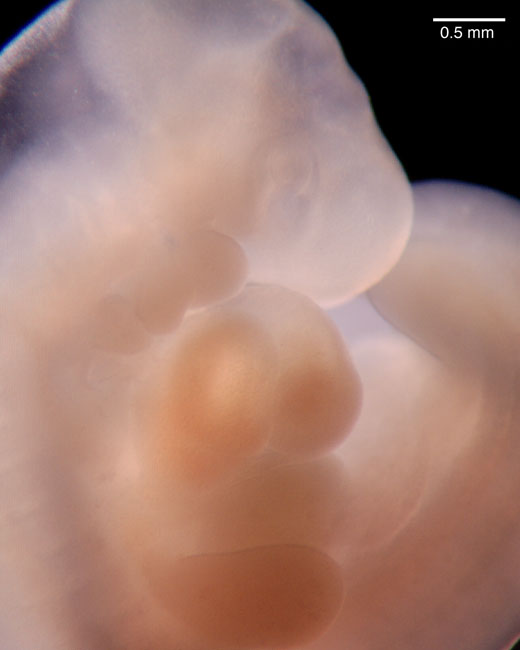 human embryo photograph