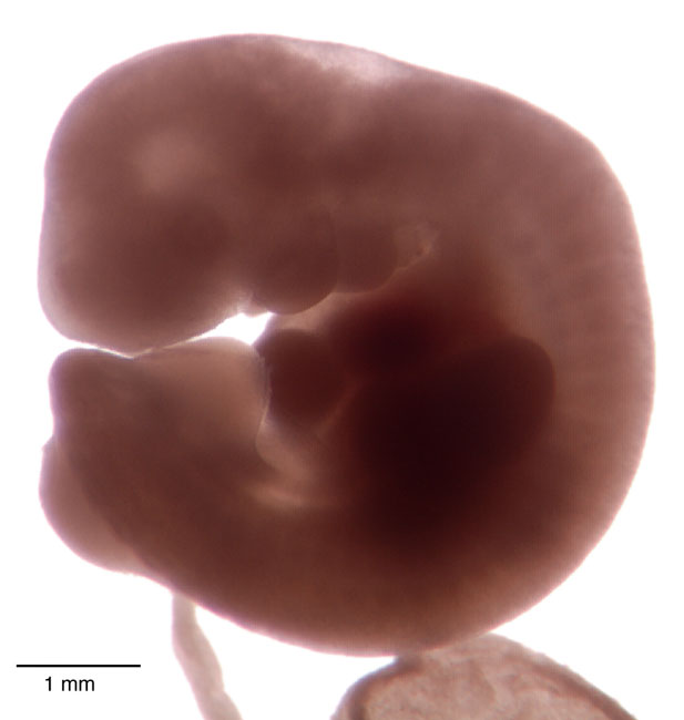 human embryo photograph