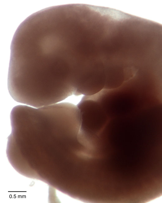 human embryo photograph