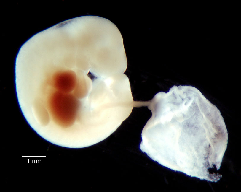 human embryo photograph