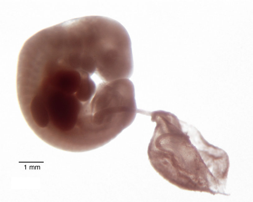 human embryo photograph