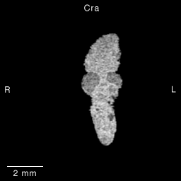 Multi-dimensional Human Embryo, Image/Animation Page