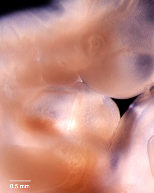 human embryo photograph