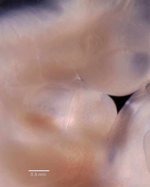 human embryo photograph