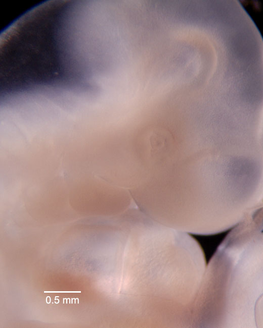 human embryo photograph