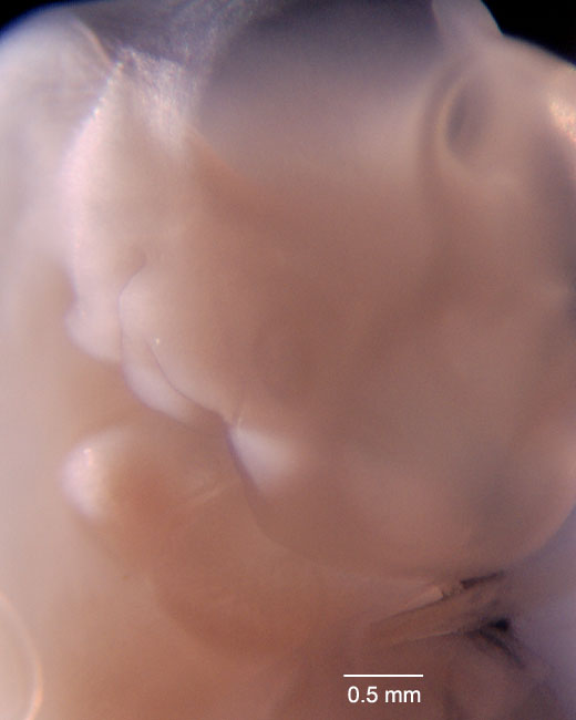 human embryo photograph