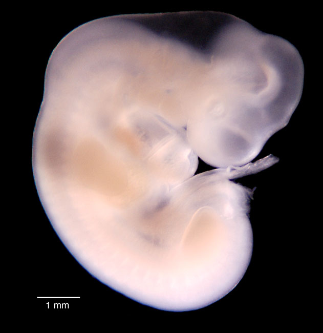 human embryo photograph