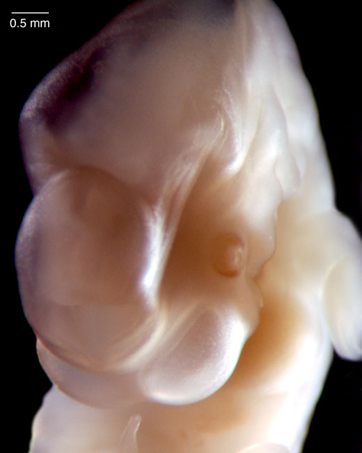 human embryo photograph