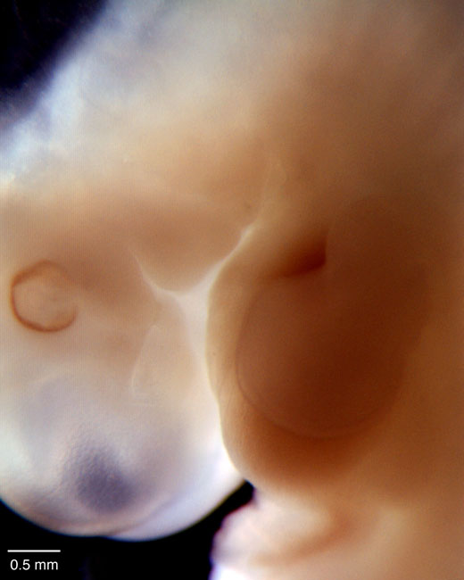 human embryo photograph