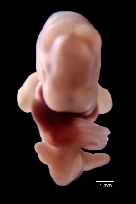 human embryo photograph