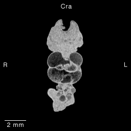 Multi-dimensional Human Embryo, Image/Animation Page