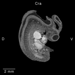 Multi-dimensional Human Embryo, Image/Animation Page