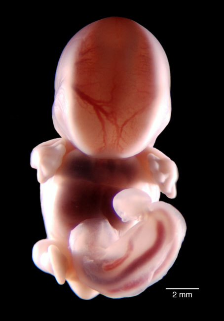 human embryo photograph