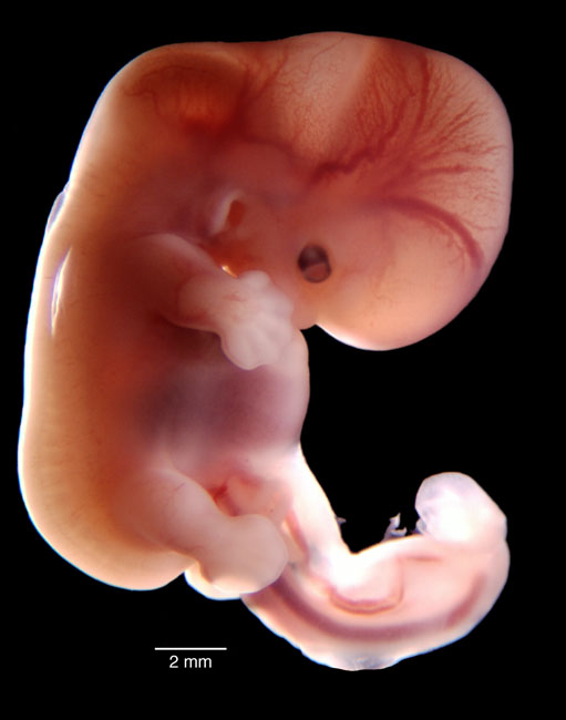 human embryo photograph