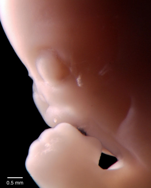 human embryo photograph