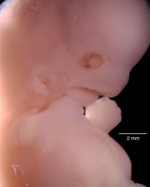 human embryo photograph