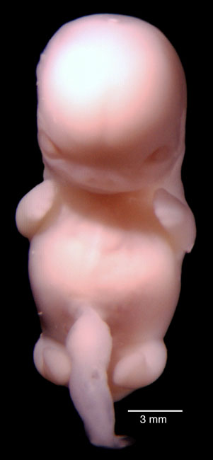 human embryo photograph