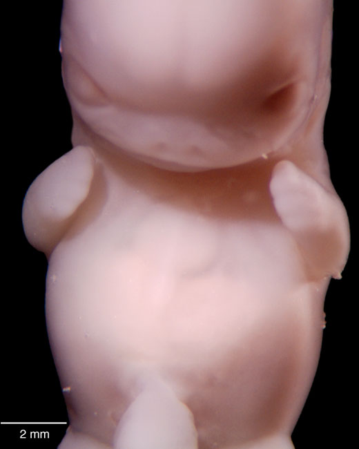 human embryo photograph