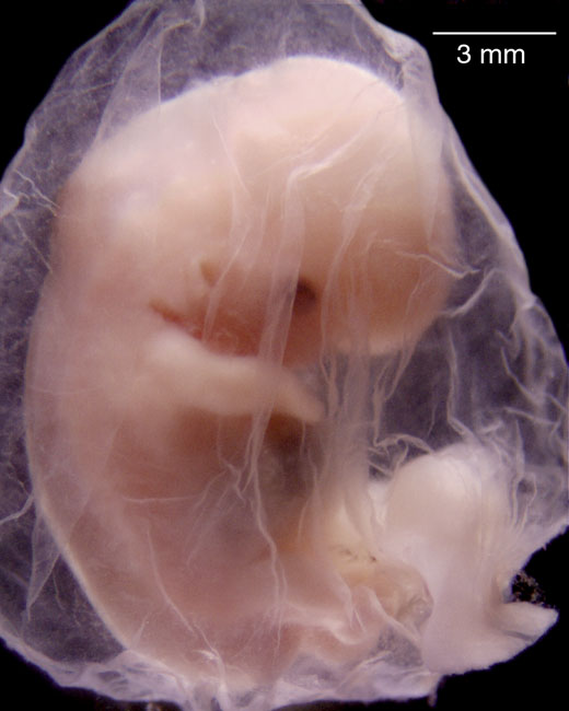 human embryo photograph