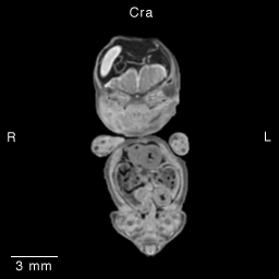 Multi-dimensional Human Embryo, Image/Animation Page