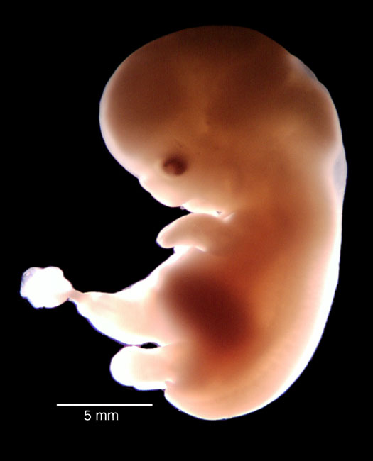 human embryo photograph