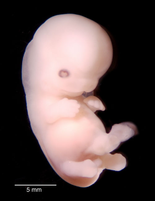 human embryo photograph