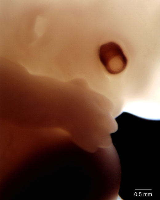 human embryo photograph