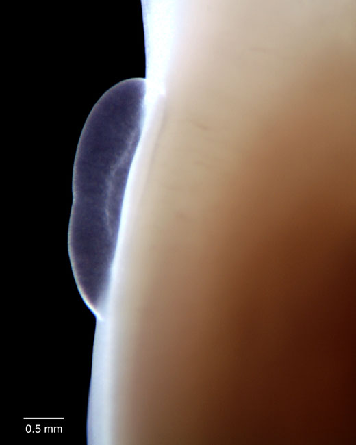 human embryo photograph