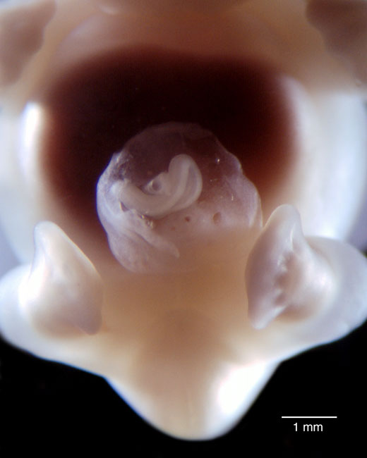 human embryo photograph