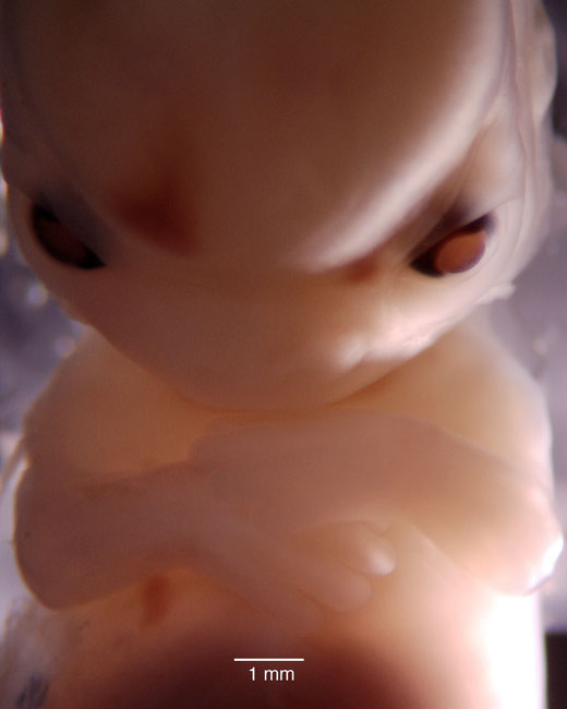 human embryo photograph