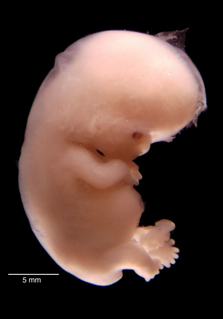 human embryo photograph