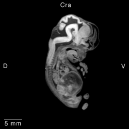 Multi-dimensional Human Embryo, Image/Animation Page