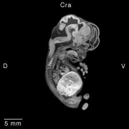 Multi-dimensional Human Embryo, Image/Animation Page