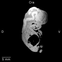 Multi-dimensional Human Embryo, Image/Animation Page