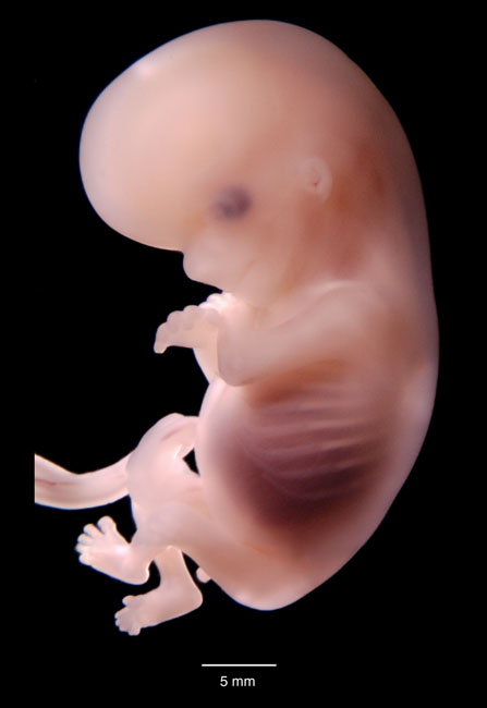 human embryo photograph