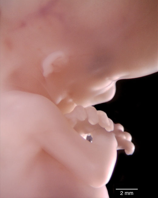 human embryo photograph