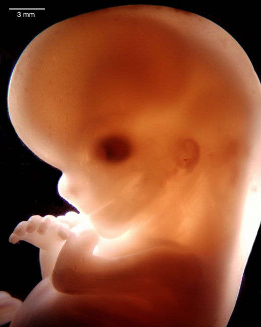 human embryo photograph