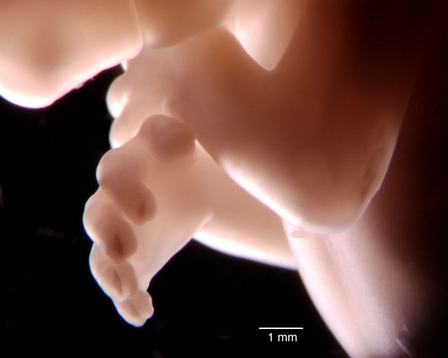 human embryo photograph