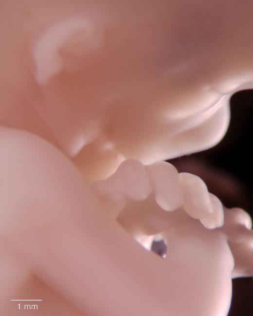 human embryo photograph