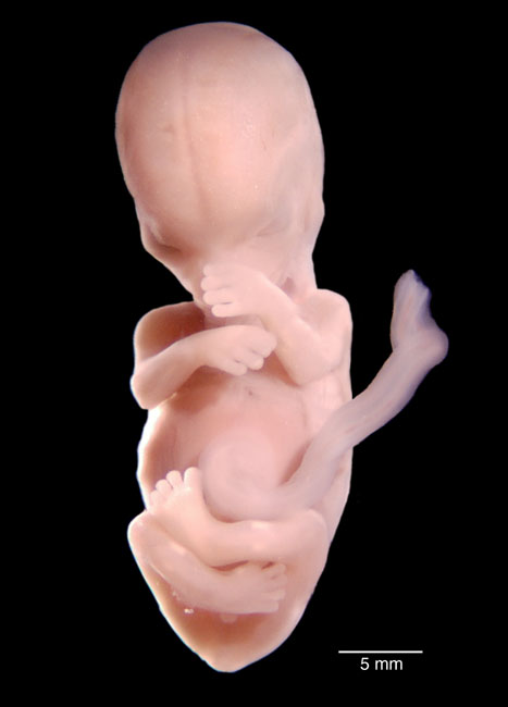 human embryo photograph