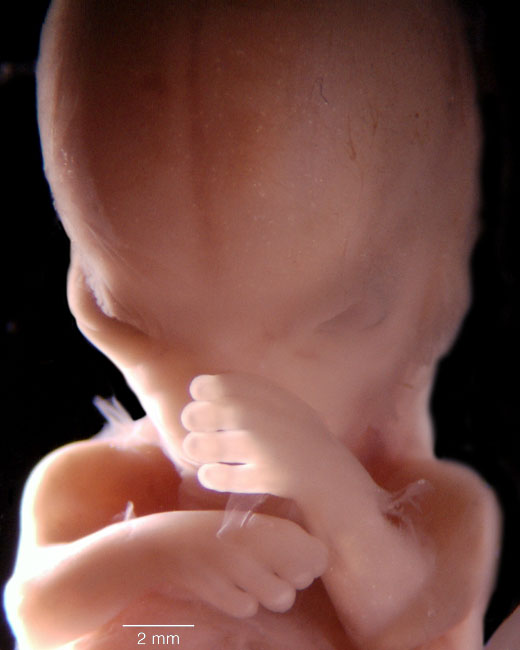 human embryo photograph