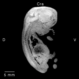 Multi-dimensional Human Embryo, Image/Animation Page