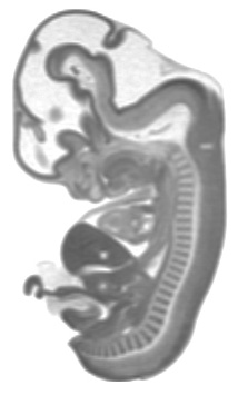 Human Embryo Logo